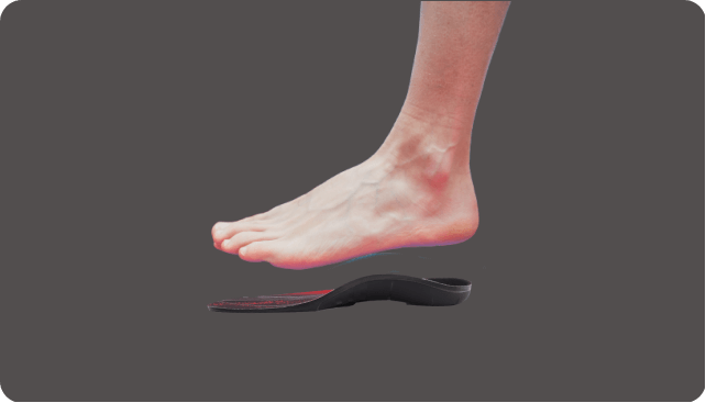 leg