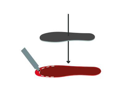 step2